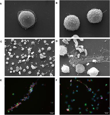 Besnoitia besnoiti-induced neutrophil clustering and neutrophil extracellular trap formation depend on P2X1 purinergic receptor signaling